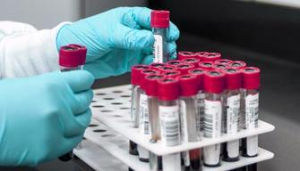 1 ДЕКАБРЯ 2025 ГОДА - ДЕНЬ ПРОФИЛАКТИКИ ВИЧ-ИНФЕКЦИИ